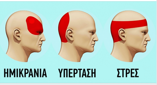 πονοκεφαλος βελονισμος ημικρανια πονοκεφαλος βελονισςμος ημικρανια